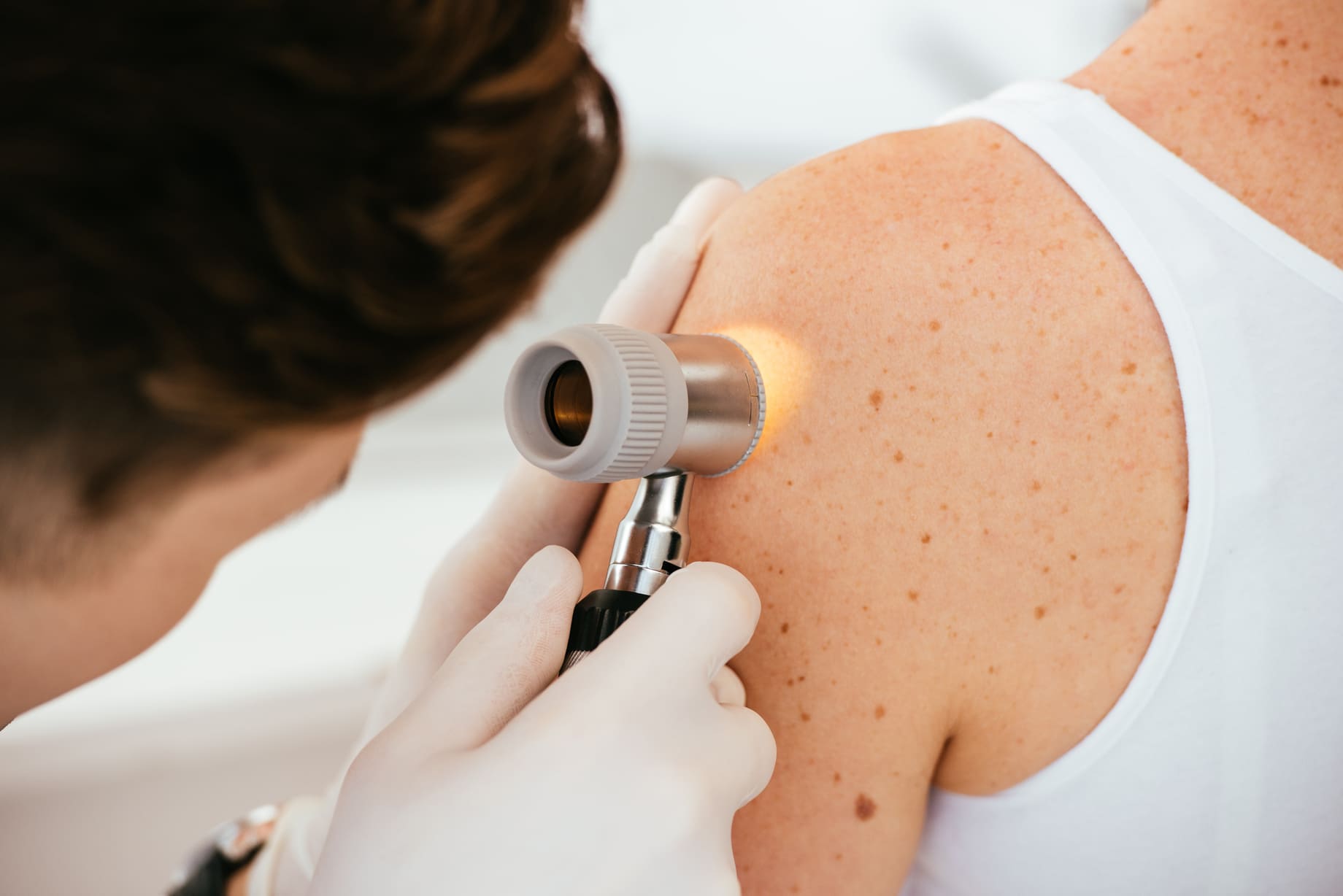 dermatologo murcia