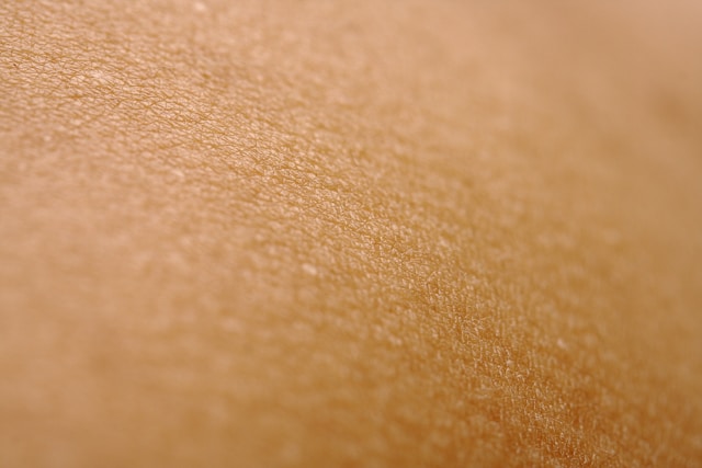 dermatologo murcia