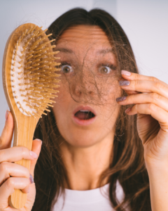 Alopecia androgenica femenina